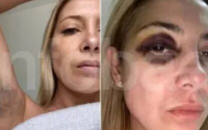 Difunden chats y fotos de Fabiola Yanez golpeada por Aberto Fernandez