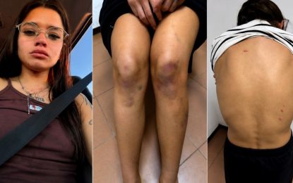 Qué dice el informe sobre las lesiones de Victoria Cantero, la joven detenida por matar a su novio en Chaco
